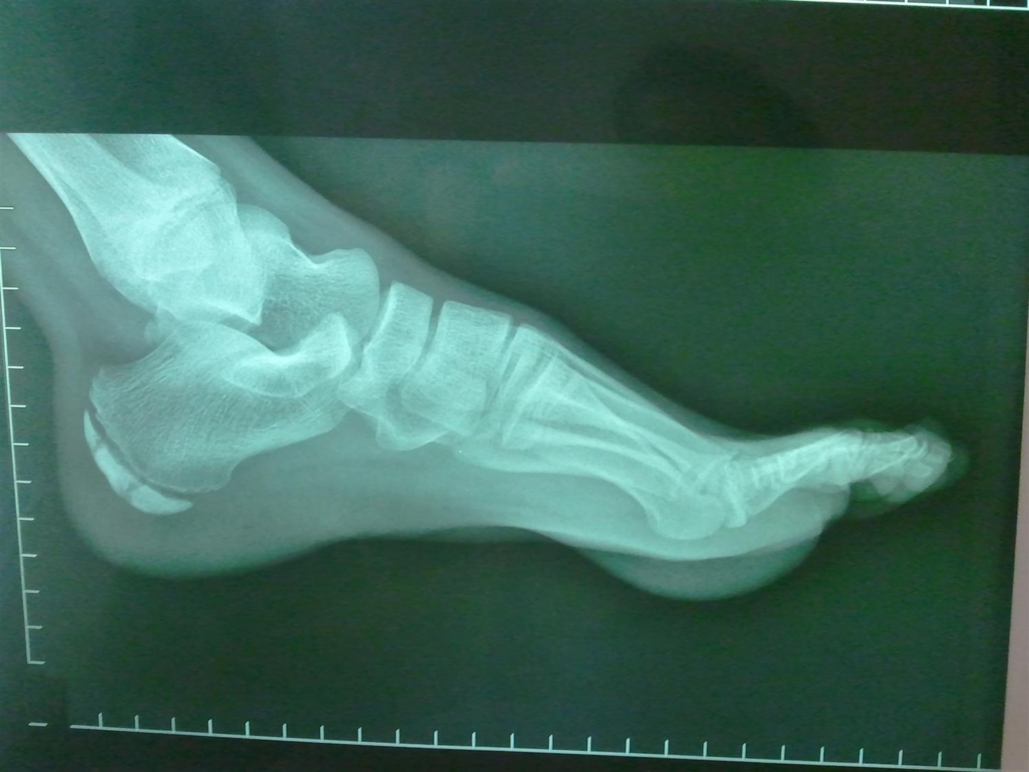  Foot & Ankle Orthobullets